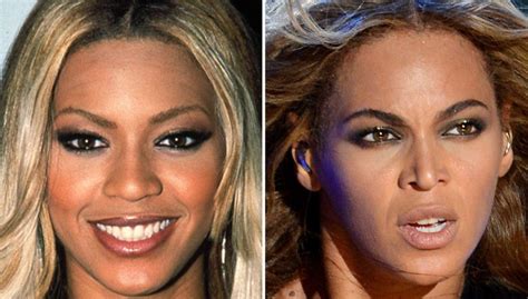 Beyonce Plastic Surgery, Nose Job