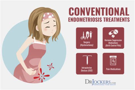 Endometriosis: Symptoms, Causes and Natural Support Strategies