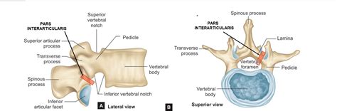 WHAT IS PARS INTERARTICULARIS?