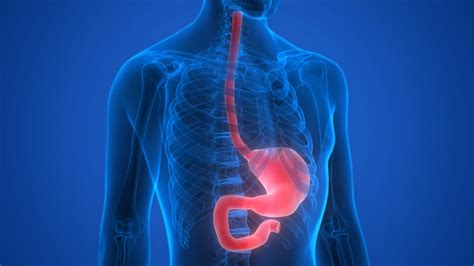 What Is Esophageal Dilation? Who Needs an Esophageal Dilation?