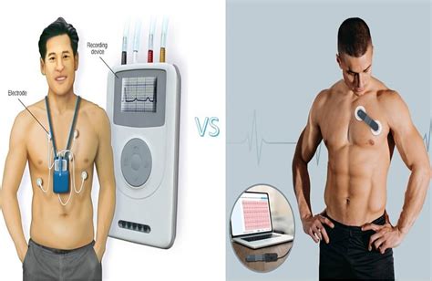 A Comparison of Holter Monitor and Wellue 24-Hour ECG Recorder with AI