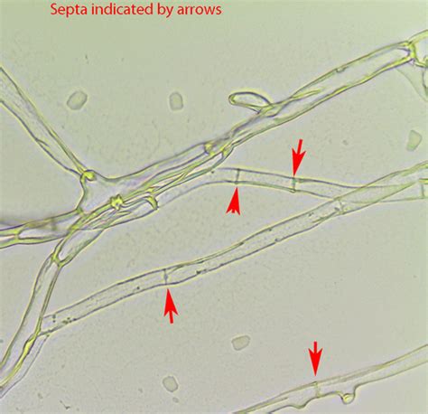 Hyphae Of Fungi Microscope