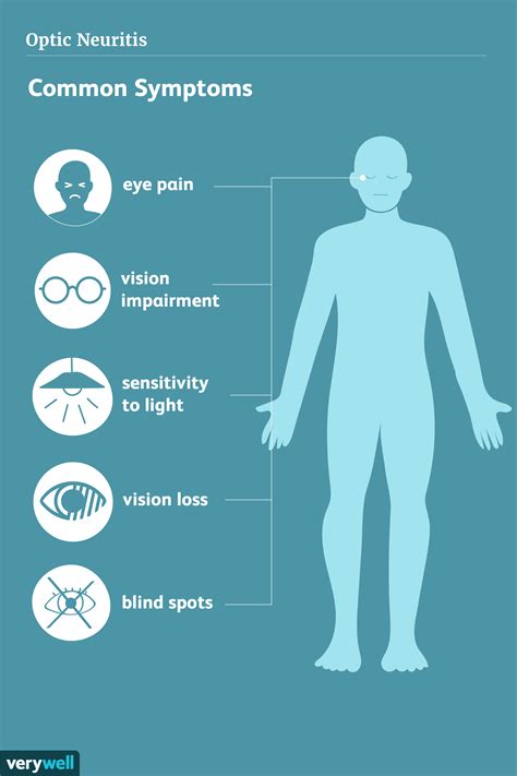 MS, Optic Neuritis, and Vision Problems