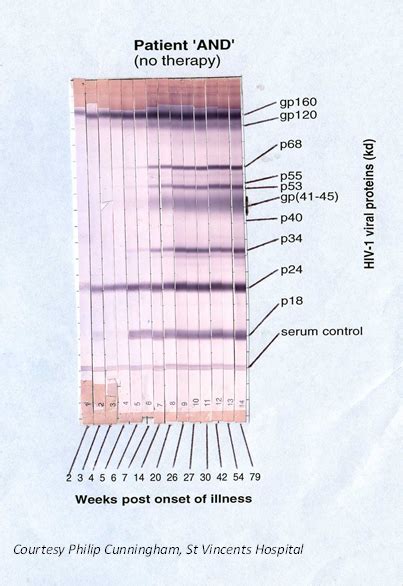 HIV antibody and antigen testing - HIV Management Guidelines