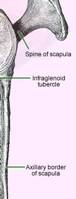 Supraglenoid Tubercle Fracture ScienceDirect, 41% OFF