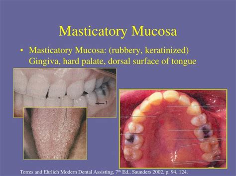 PPT - Oral Mucosa DHY114 – Week 1 PowerPoint Presentation - ID:6929210