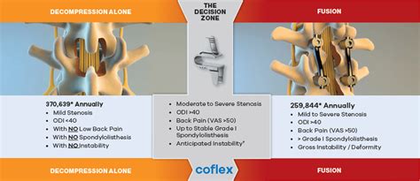 Why Coflex®? | Coflex®