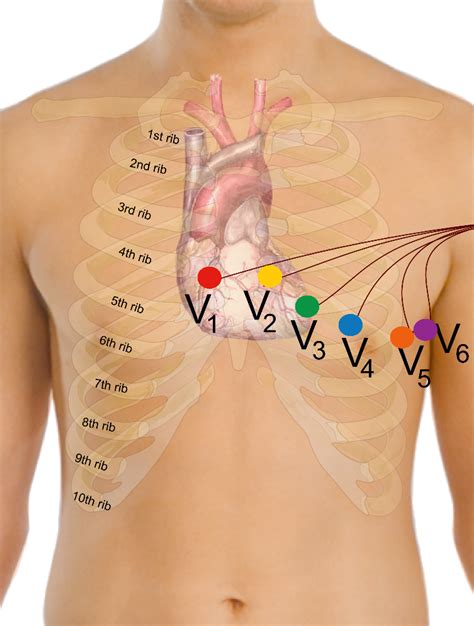 BYOP EKG electrode placement instructions : Curavi Health Support