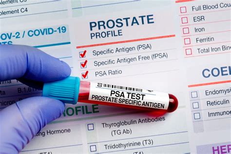 All About the Prostate-Specific Antigen Test - TULSA Procedure