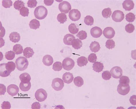 ghost cells Archives | eClinpath