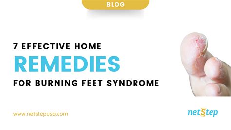 7 Effective Home Remedies for Burning Feet Syndrome