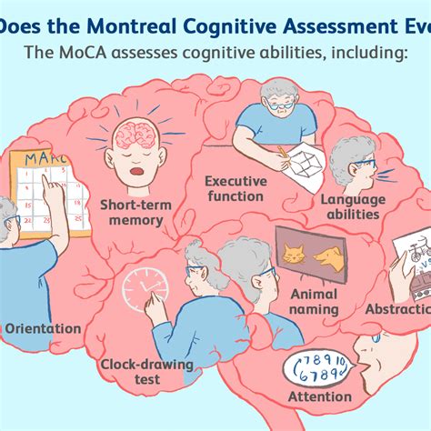 Moca cognitive - talkingvint