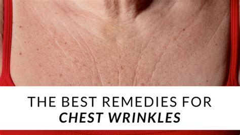 The Best Remedies For Chest Wrinkles - Erase Cosmetics