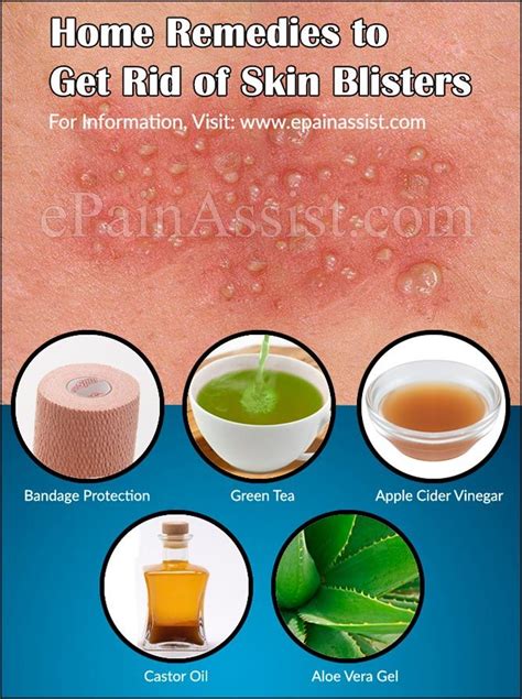 Pin on Skin Diseases