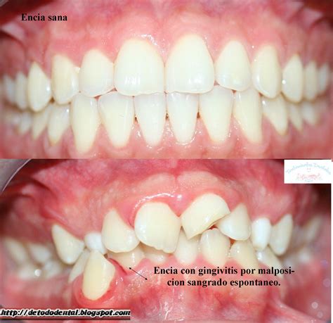 TRATAMIENTOS DENTALES: enero 2011