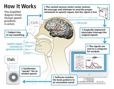 Brain-Machine Interface Could Give Voice to the Voiceless | Discover ...