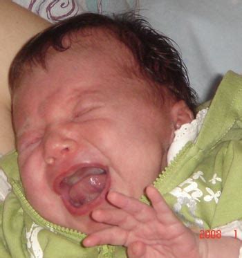 File:Crying baby.jpg - Wikimedia Commons