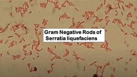 Serratia Gram Stain