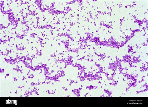 Corynebacterium Under Microscope