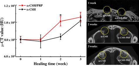 Figure 1 from An Innovative Bioceramic Bone Graft with Platelet-Rich ...