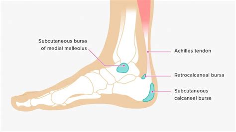 Ankle Pain: Common Causes and Management - Lilyfield Physiotherapy