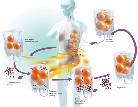 Convergence of gene and cell therapy - RegMedNet