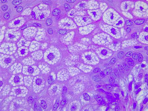 Sebaceous Gland Structure