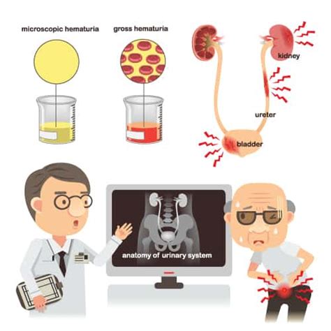 Can Diabetes Make You Smell - DiabetesWalls