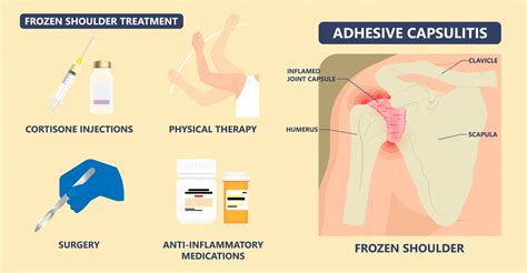 Adhesive capsulitis - Knee, Hip and Shoulder