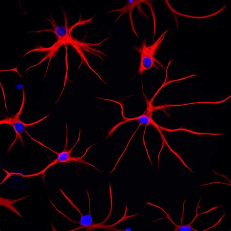 Mutation in common protein triggers tangles, chaos inside brain cells