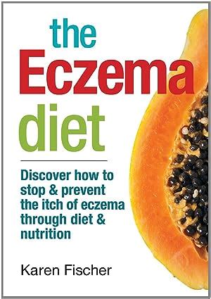 The Eczema Diet: Discover How to Stop and Prevent The Itch of Eczema ...