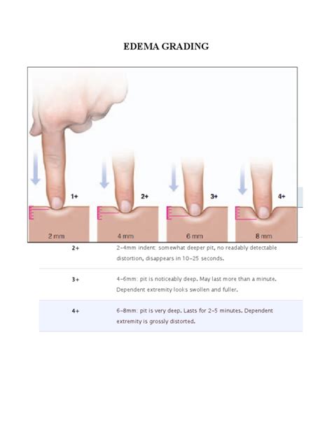 Edema Grading: Grade 1+ | PDF