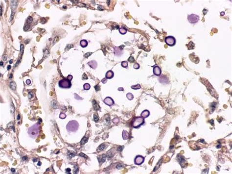 CRYPTOCOCCUS sp. Control Histology Slides - Newcomer Supply