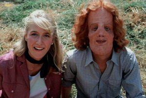 10 Heart-Rending Facts About Rocky Dennis, Whose Rare Deformity Was The ...