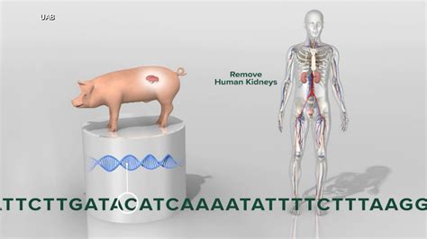 Medical breakthrough: First pig to human kidney transplant - Good ...