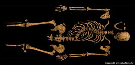 Analysing the skeleton | Richard III: Discovery and identification ...