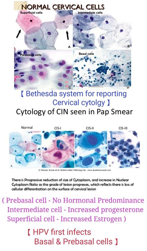 Cervical cytology - Normal & Abnormal 【 Note : Increase Nucleus ...