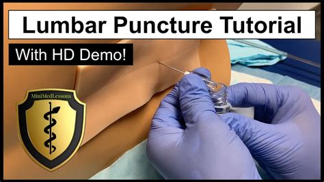 Lumbar Puncture Form Fill Out And Sign Printable Pdf - vrogue.co