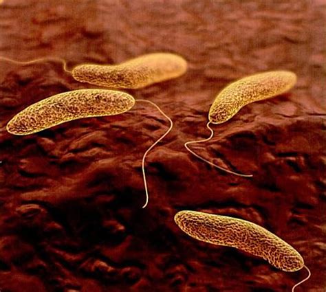 LaoSaiKia_Cholera: Vibrio Cholerae