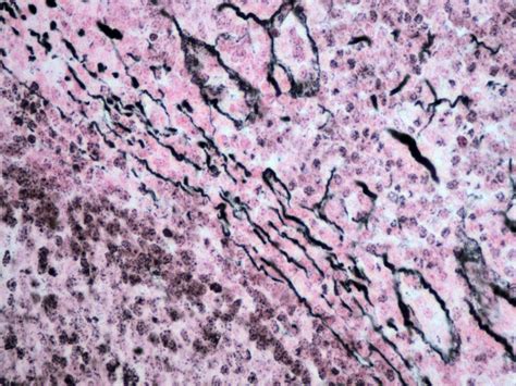 Reticular Connective Tissue Labeled