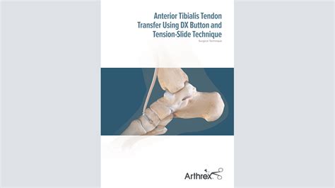 Arthrex - FHL Tendon Transfer