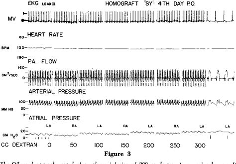 Figure 3 from The Bainbridge Reflex in Canine Cardiac Autotransplants | Semantic Scholar