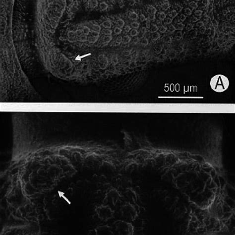 -A: scanning electron micrograph view of a Triatoma infestans fifth... | Download Scientific Diagram