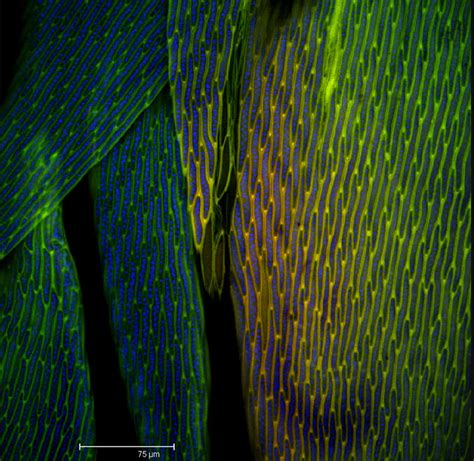 Microscopy - Common Moss