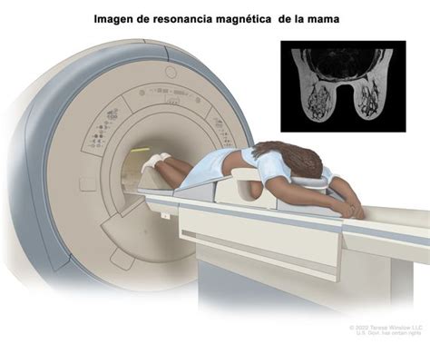 Bio Resonancia Magnetica