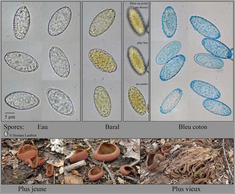 Peziza phyllogena: spores | HL1752 Spores ellipsoïdes, finem… | Flickr