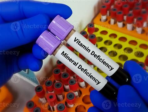 Scientist hold two blood sample one is order for Vitamin deficiency test another is Mineral ...