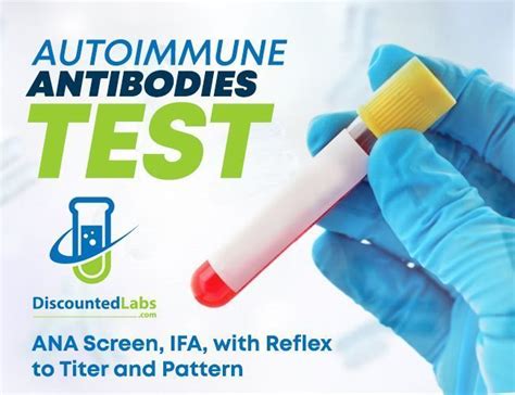 Autoimmune Antibodies: ANA Screen, IFA, with Reflex to Titer and Pattern