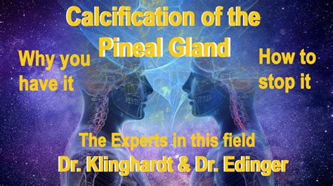 Calcification of your Pineal Gland and how to stop it. - YouTube