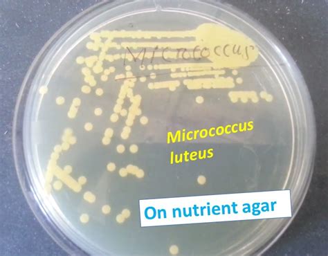 Nutrient agar: Introduction, Composition, Preparation, Test Procedure